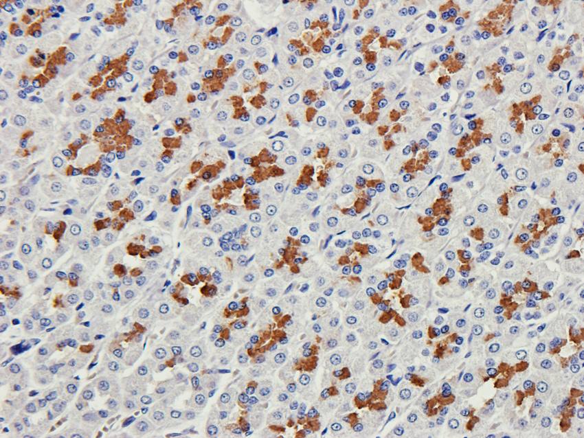 Collagen 4 alpha 1 Rabbit Polyclonal Antibody