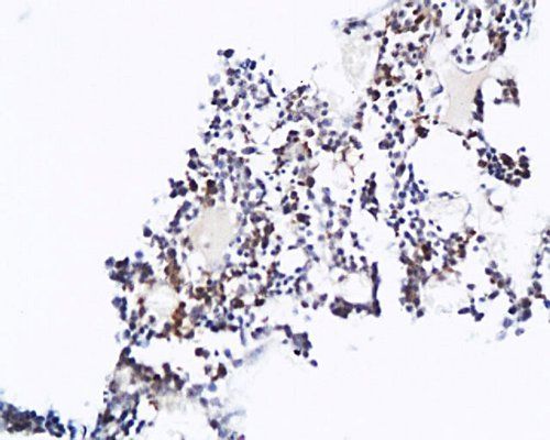 COL2A1 Rabbit Polyclonal Antibody