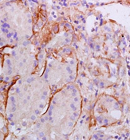 COL2A1 Rabbit Polyclonal Antibody