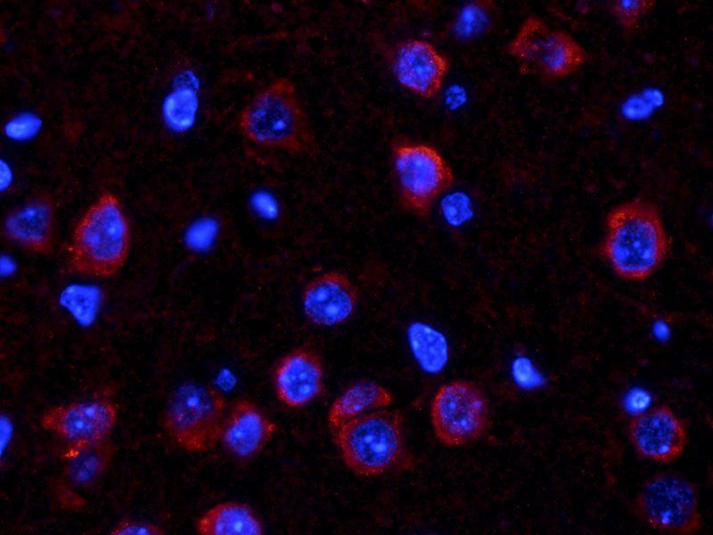 COL2A1 Rabbit Polyclonal Antibody