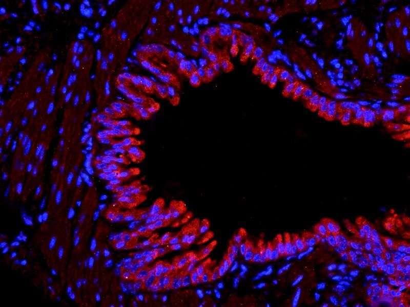 COL2A1 Rabbit Polyclonal Antibody