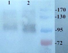 COL2A1 Rabbit Polyclonal Antibody