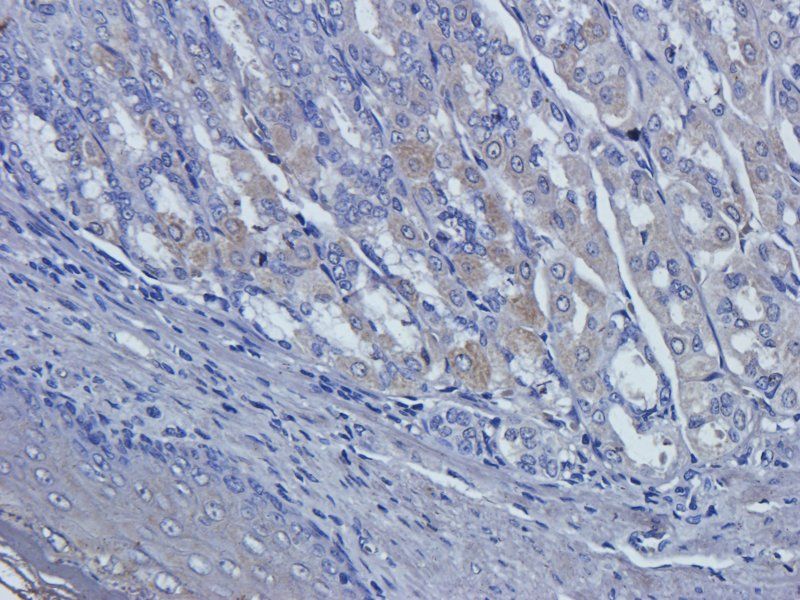 Collagen III Rabbit Polyclonal Antibody