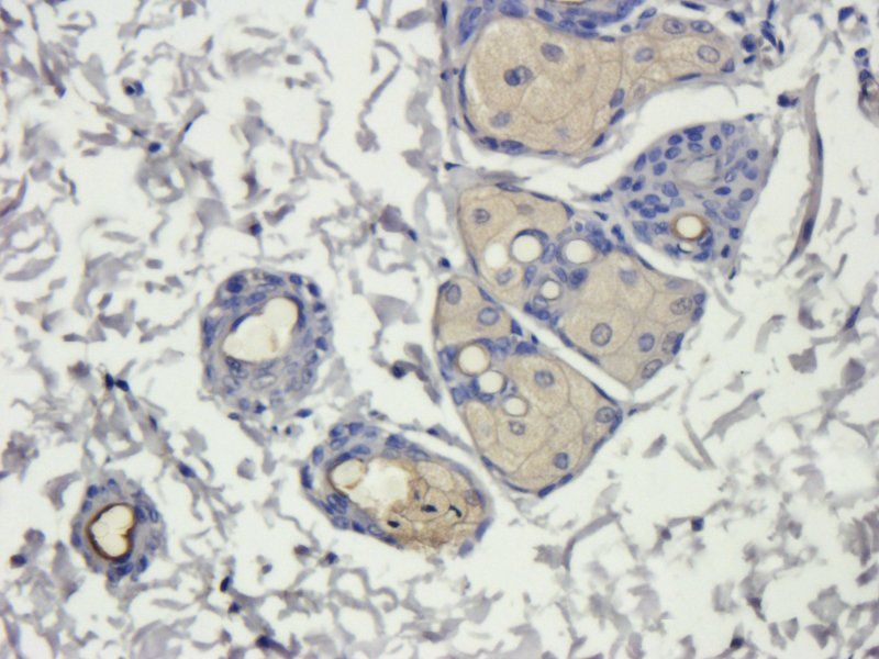 Collagen IV Rabbit Polyclonal Antibody