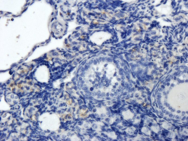 Collagen IV Rabbit Polyclonal Antibody