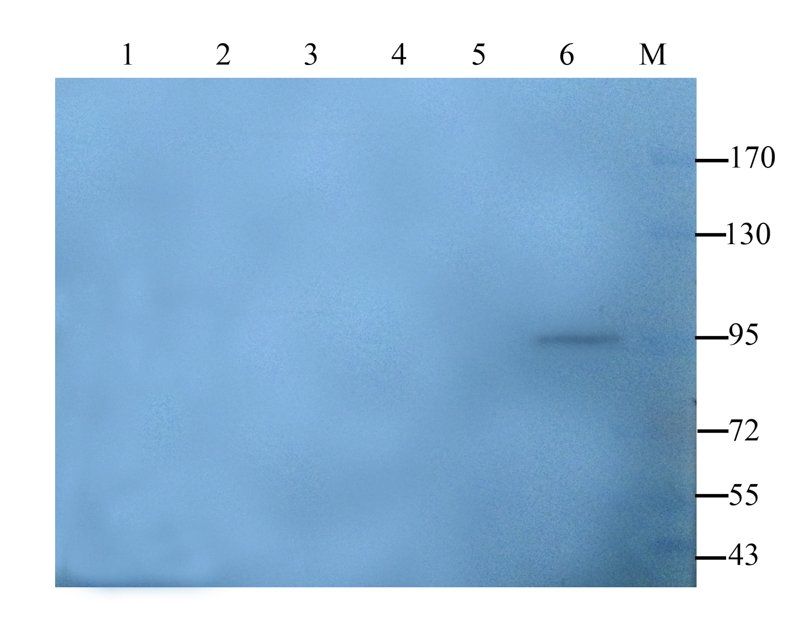 Collagen IV Rabbit Polyclonal Antibody
