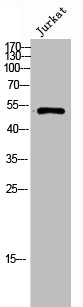 CORO1A Antibody