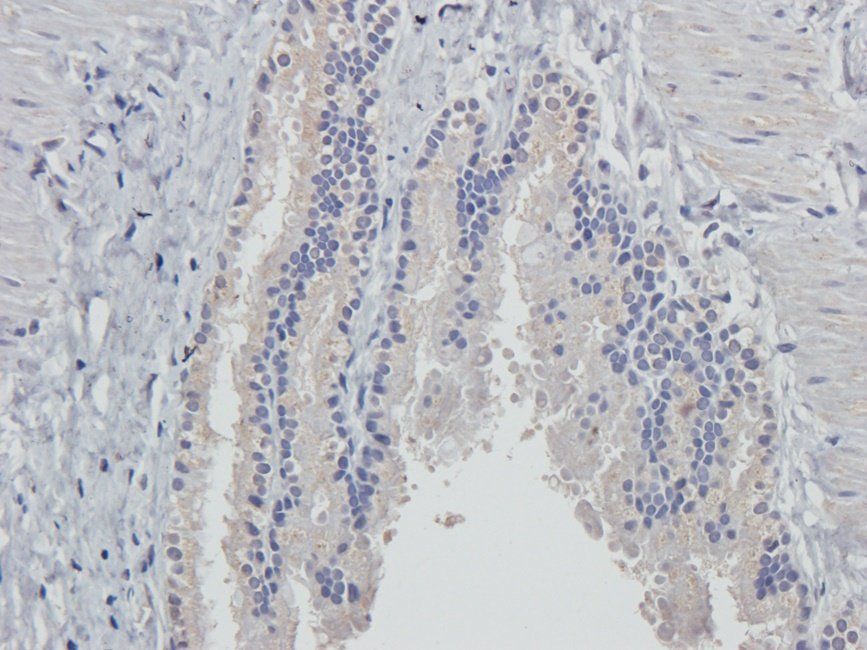Cox2 Rabbit Polyclonal Antibody