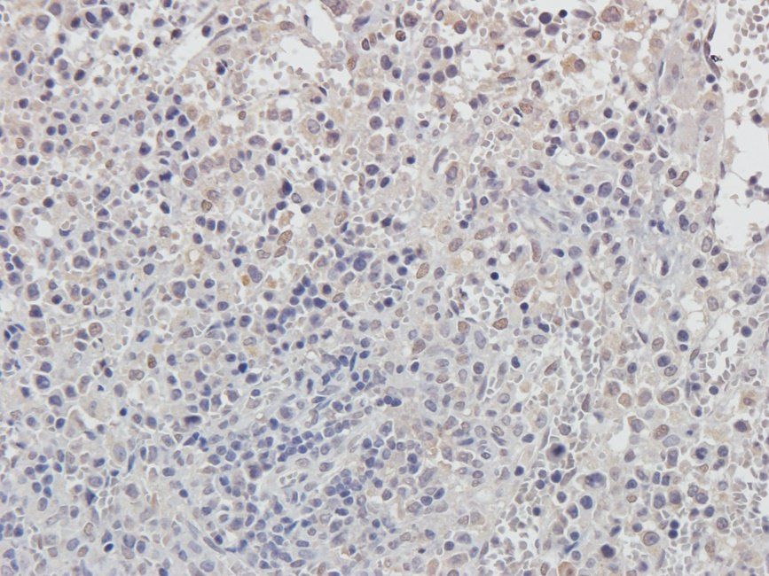 Cox2 Rabbit Polyclonal Antibody