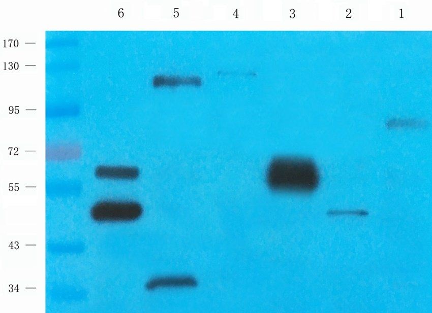 Cox2 Rabbit Polyclonal Antibody