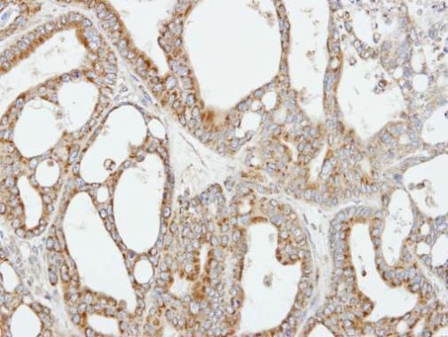 COX5B Rabbit Polyclonal Antibody