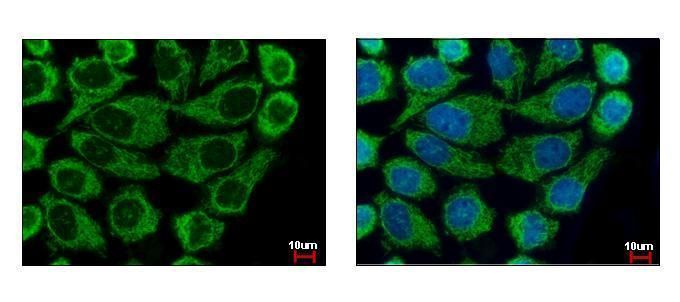 COX6B1 Rabbit Polyclonal Antibody