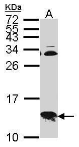 COX6B1 Rabbit Polyclonal Antibody