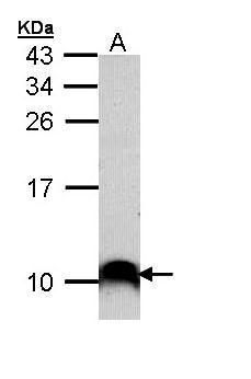 COX7B2 Rabbit Polyclonal Antibody