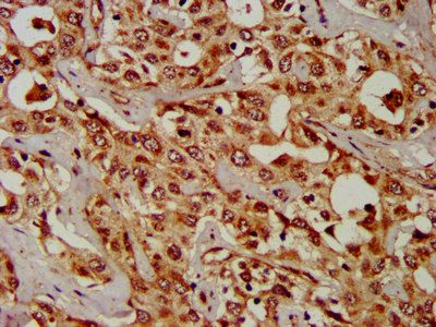 CPS1 Antibody
