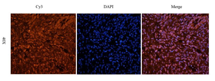 Cpt1a Rabbit Polyclonal Antibody