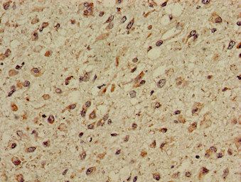 CPT1C Antibody