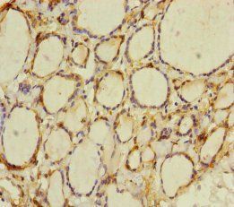 CRBN Antibody