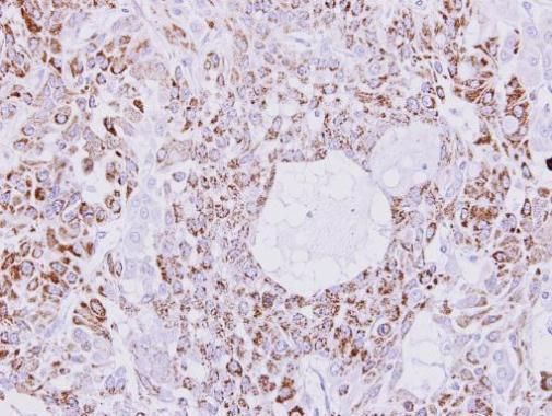 Creatine kinase MT Rabbit Polyclonal Antibody