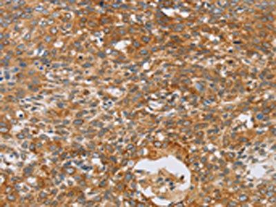 CRELD2 Antibody