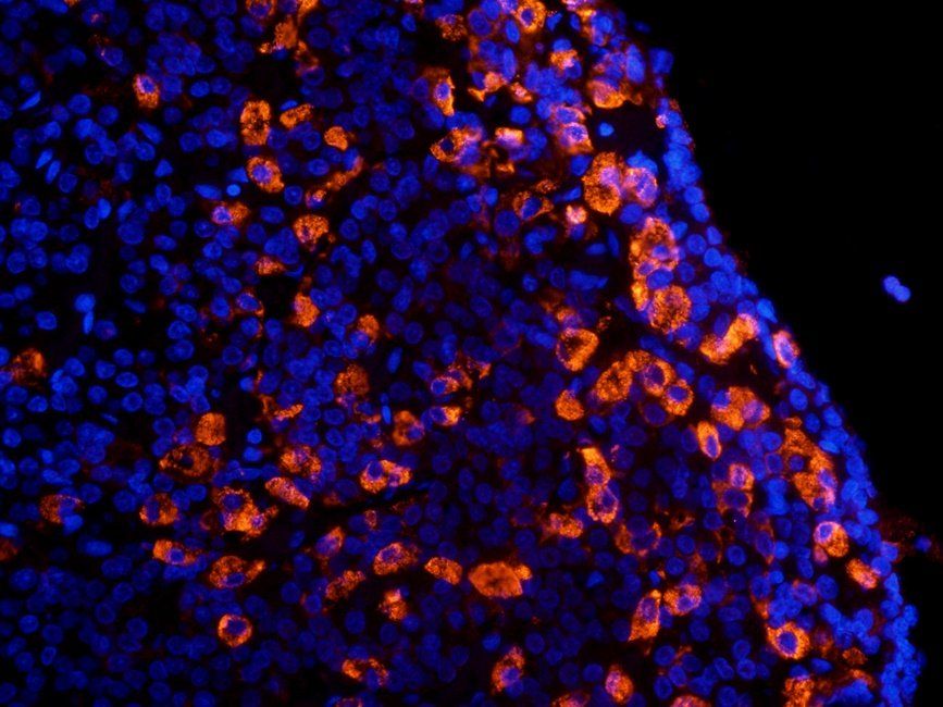 CRHR2 Rabbit Polyclonal Antibody