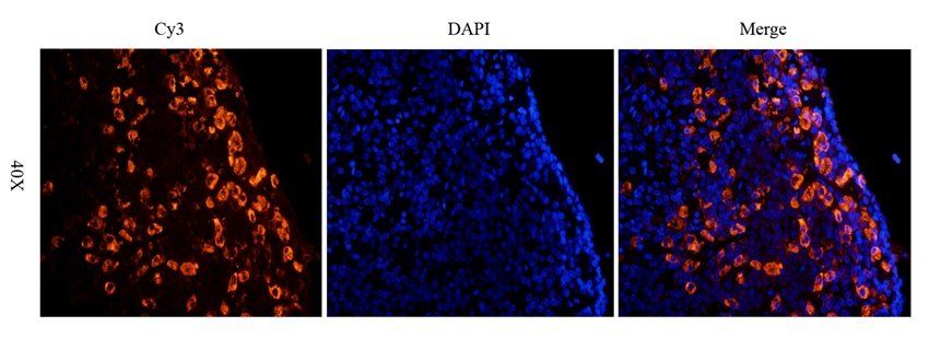CRHR2 Rabbit Polyclonal Antibody