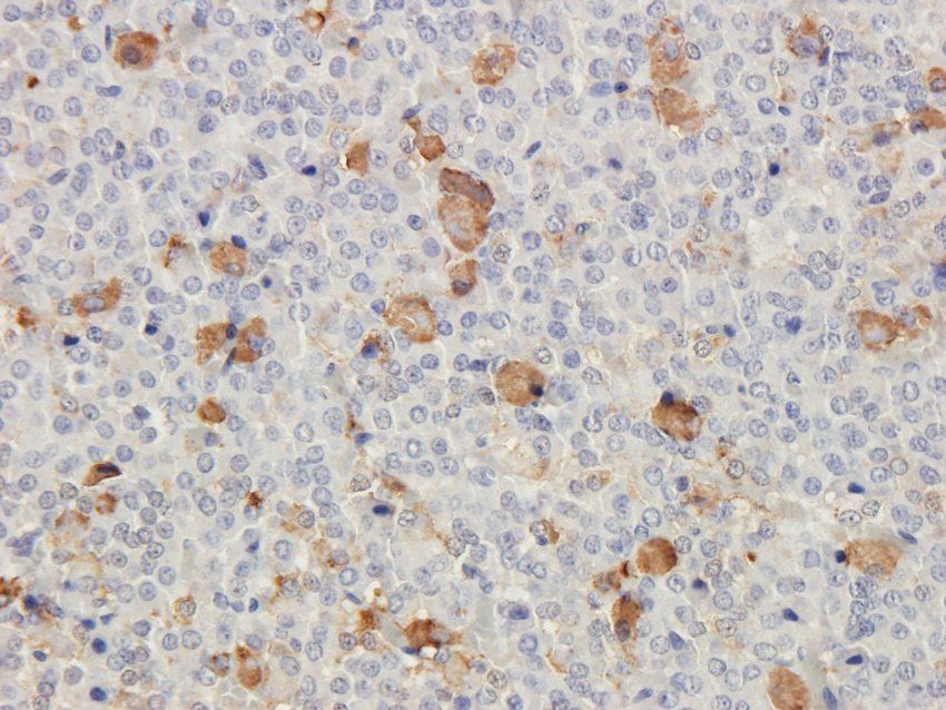 CRHR2 Rabbit Polyclonal Antibody