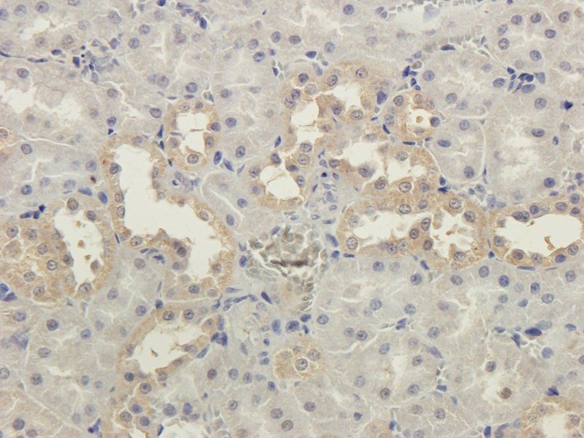 CRHR2 Rabbit Polyclonal Antibody