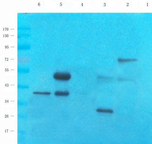 CRHR2 Rabbit Polyclonal Antibody