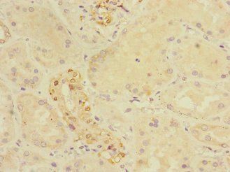 CRIP1 Antibody