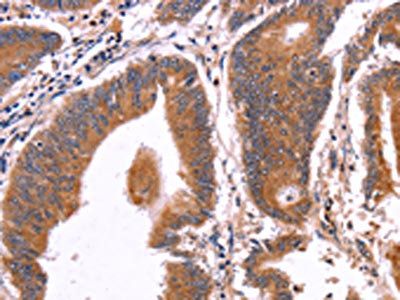 CRISP3 Antibody