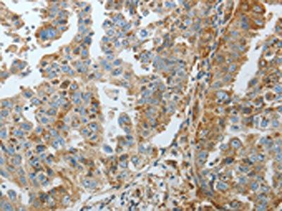 CRMP1 Antibody