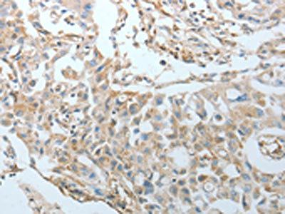CRMP1 Antibody