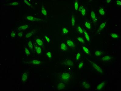 HIST1H3A Antibody