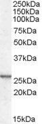 CRP2/CSRP2 Antibody