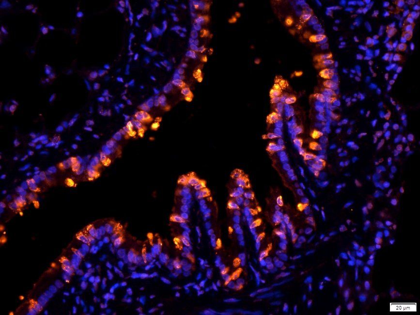 CRUM3 Rabbit Polyclonal Antibody