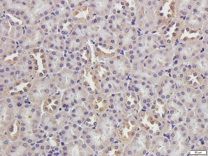 CRUM3 Rabbit Polyclonal Antibody