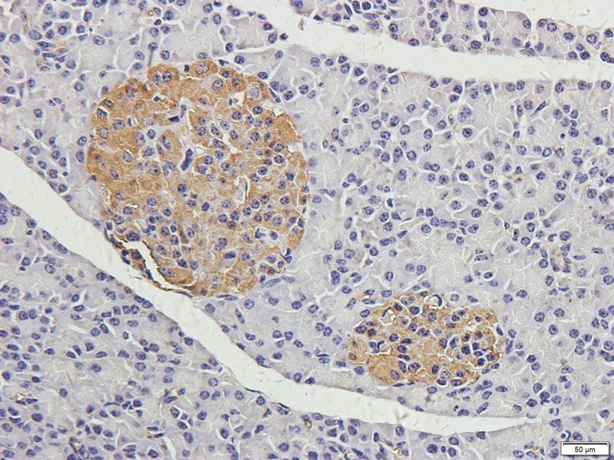 CRUM3 Rabbit Polyclonal Antibody