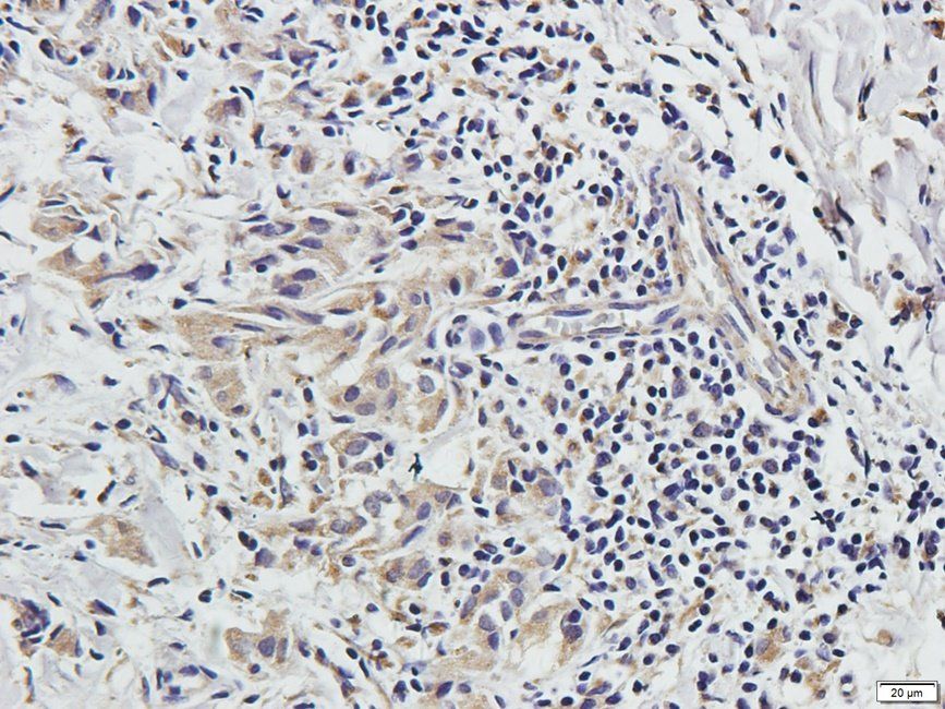CRUM3 Rabbit Polyclonal Antibody