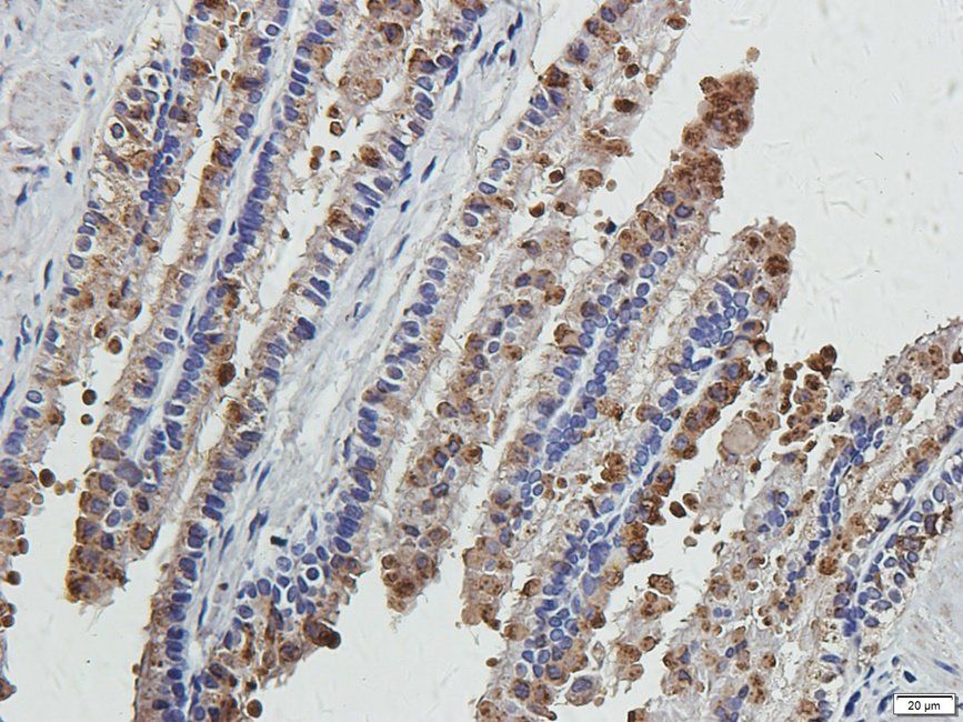 CRUM3 Rabbit Polyclonal Antibody