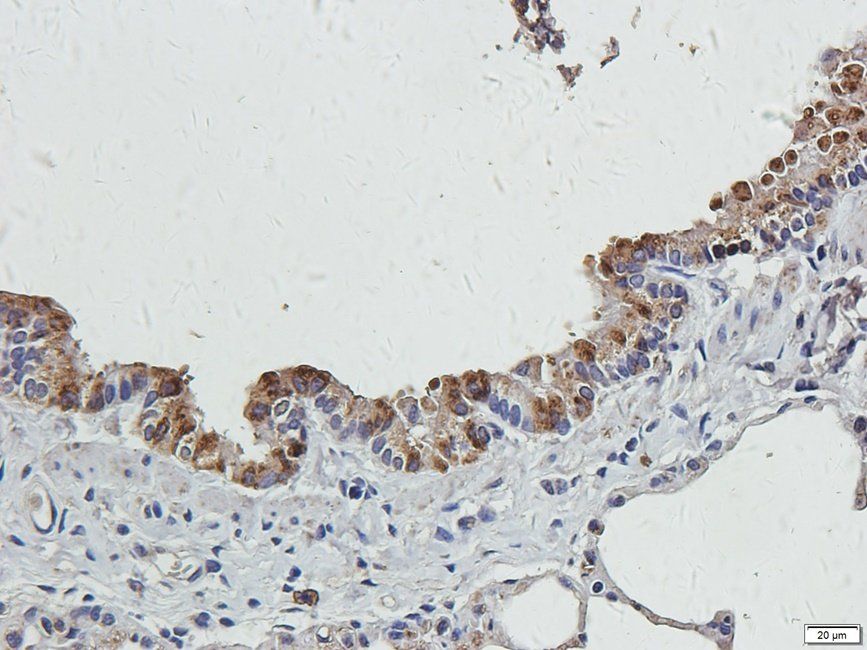 CRUM3 Rabbit Polyclonal Antibody
