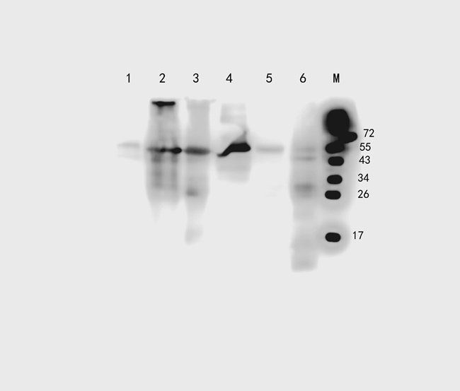CRUM3 Rabbit Polyclonal Antibody