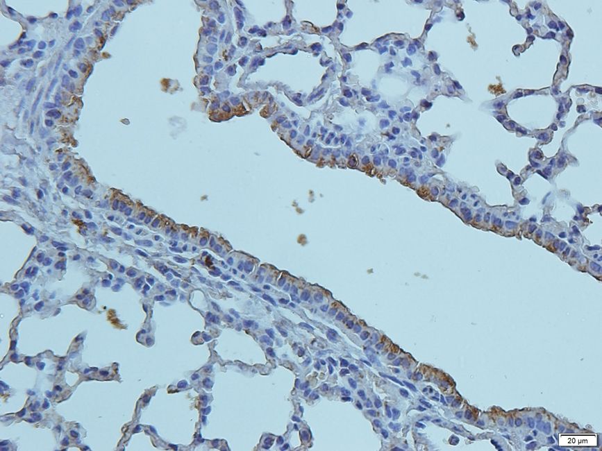 Cryopyrin Rabbit Polyclonal Antibody