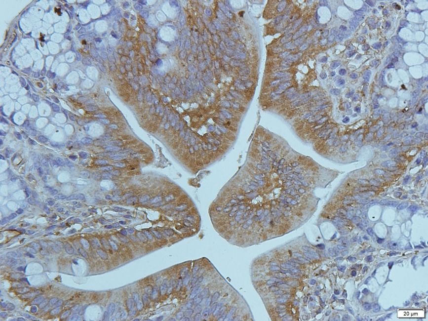 Cryopyrin Rabbit Polyclonal Antibody
