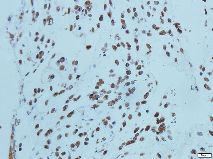 Cryopyrin Rabbit Polyclonal Antibody