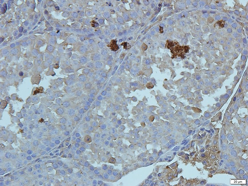 Cryopyrin Rabbit Polyclonal Antibody