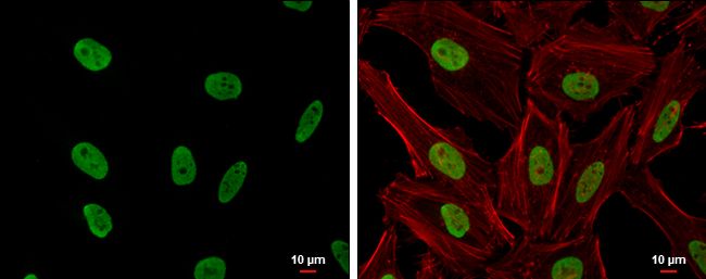 CSB Rabbit Polyclonal Antibody