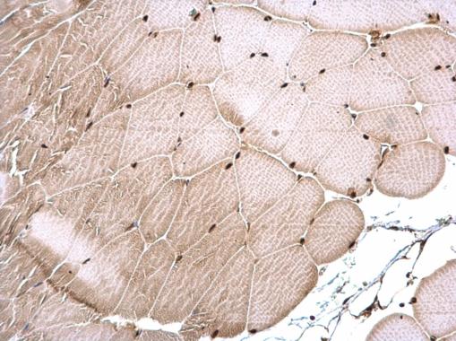 CSB Rabbit Polyclonal Antibody