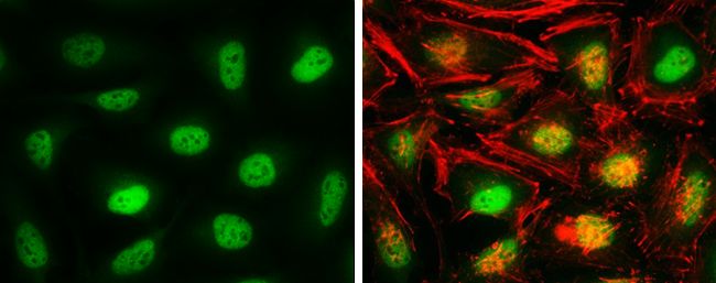 CSE1L Rabbit Polyclonal Antibody