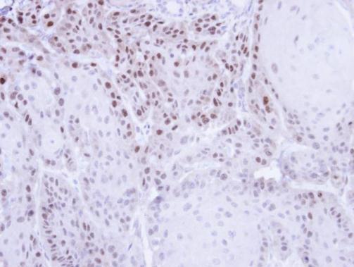 CSE1L Rabbit Polyclonal Antibody